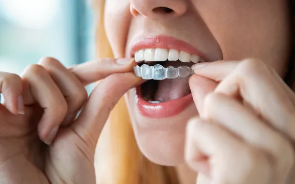 Invisalign